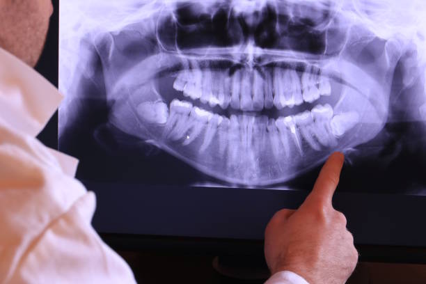 Best Emergency TMJ Treatment in Redwood Falls, MN