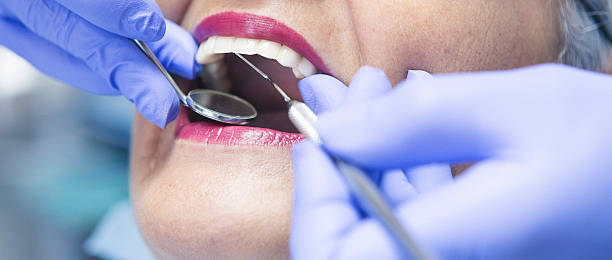 Best Emergency Gum Treatment in Redwood Falls, MN